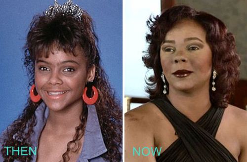 Lark Voorhies Plastic Surgery Before and After