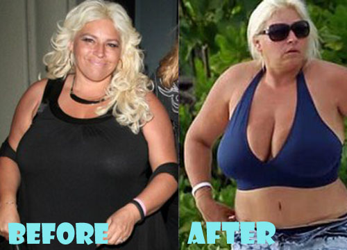 Beth Chapman Plastic Surgery Before and After Pictures