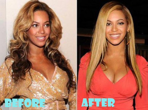 Beyonce Plastic Surgery