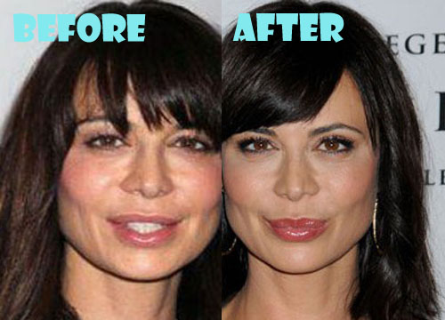 Catherine Bell Plastic Surgery Before and After