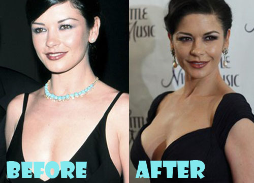 Catherine Zeta Jones Plastic Surgery Boob Job