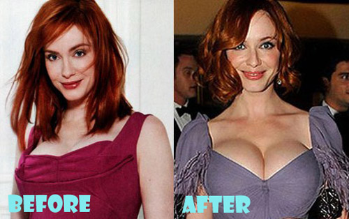 Christina Hendricks Plastic Surgery Breast Implant