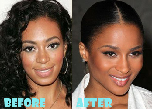 Ciara Plastic Surgery Nose Job Before and After.