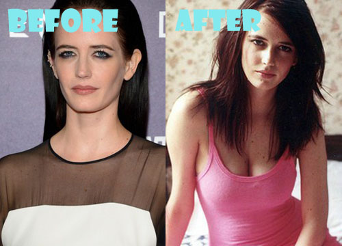 Eva Green Plastic Surgery Before and After Pictures