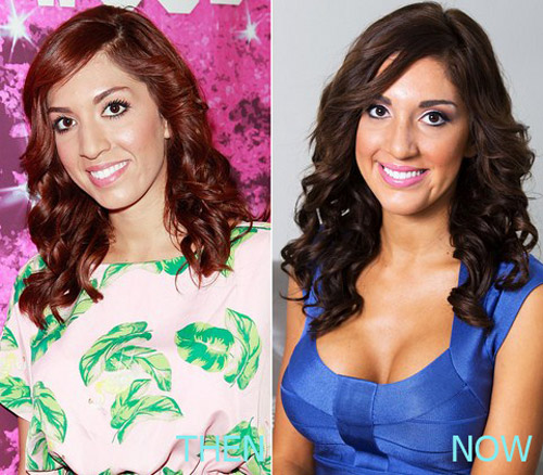 Farrah Abraham Plastic Surgery