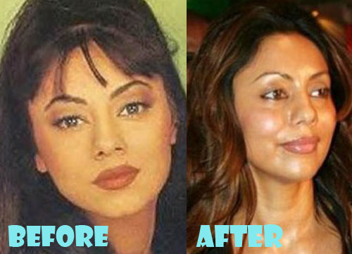 Gauri Khan Plastic Surgery Before and After Pictures