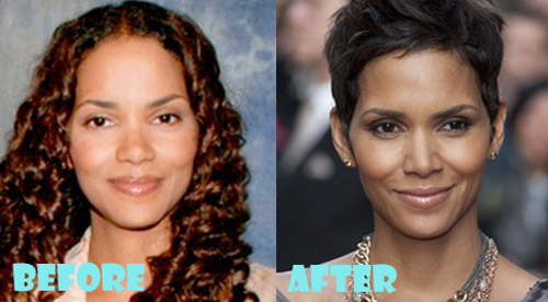 Halle Berry Plastic Surgery Before and After