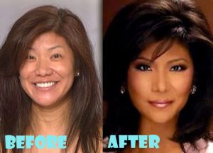 Julie Chen Plastic Surgery Nose Job