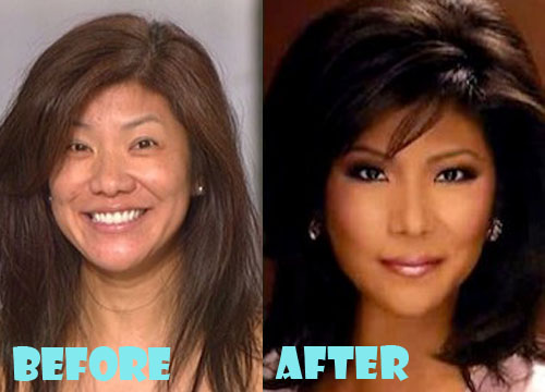 Julie Chen Plastic Surgery Before and After Nose Job