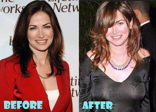 Kim Delaney Plastic Surgery Boob Job