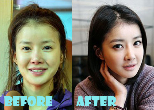 Lee Si Young Plastic Surgery Before and After Pictures