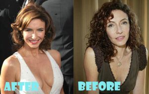 Mary Steenburgen Plastic Surgery Boob Job
