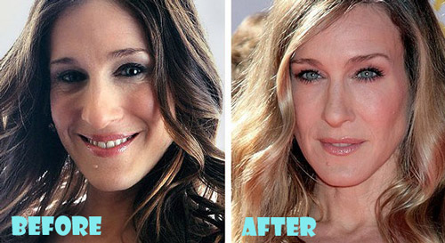 Sarah Jessica Parker Plastic Surgery Before and After Nose Job