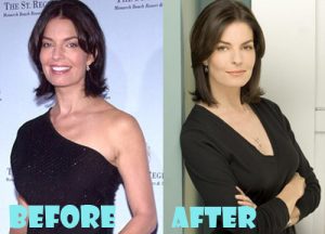 Sela Ward Plastic Surgery