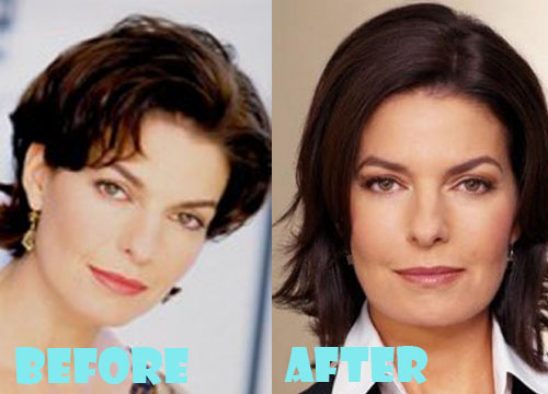 Sela Ward Plastic Surgery Before and After Pictures