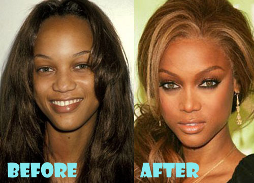 Tyra Banks Plastic Surgery Before and After Nose Job 