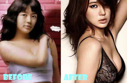 Yoon Eun Hye Plastic Surgery Before and After