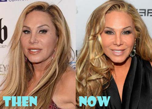 Adrienne Maloof Plastic Surgery Before and After Photos