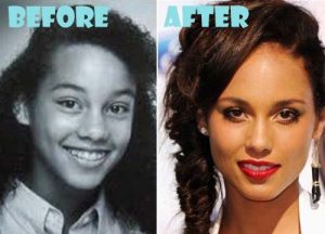 Alicia Keys Plastic Surgery