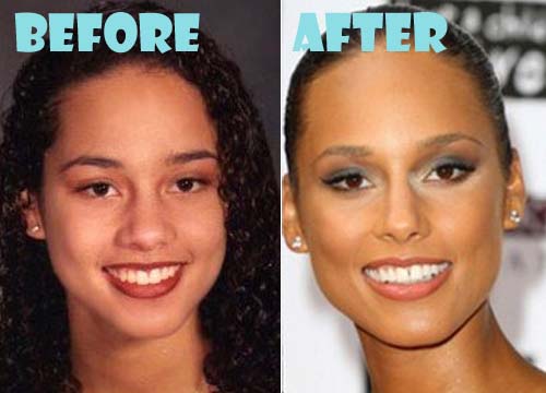 Alicia Keys Plastic Surgery Before and After Nose Job