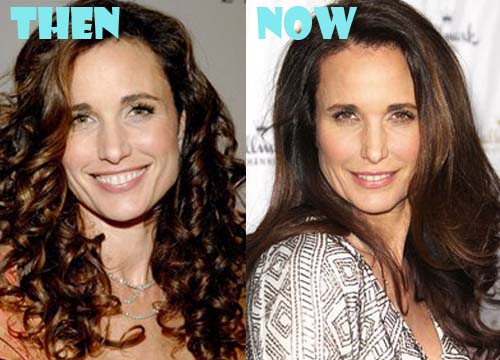 Andie MacDowell Plastic Surgery Before and After Photos