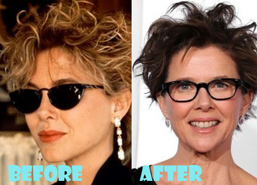 Annette Bening Plastic Surgery Before and After Picture