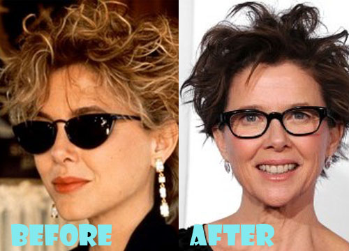 Annette Bening Plastic Surgery