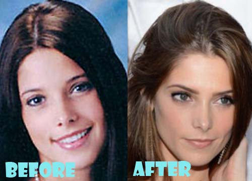 Ashley Greene Plastic Surgery Before and After Nose Job