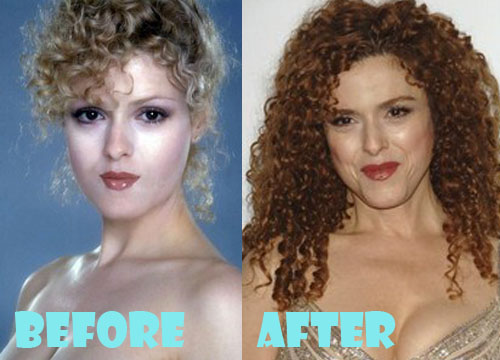 Bernadette Peters Plastic Surgery Before and After Pictures