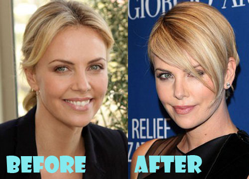 Charlize Theron Plastic Surgery Before and After Pictures