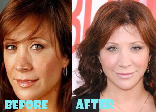 Cheri Oteri Plastic Surgery Before and After Pictures