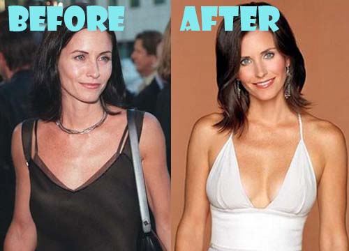 Courteney Cox Plastic Surgery Before and After Boob Job