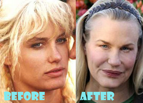 Daryl Hannah Plastic Surgery