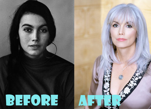 Emmylou Harris Plastic Surgery Before and After Picture