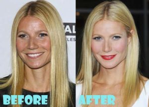 Gwyneth Paltrow Plastic Surgery Facelift