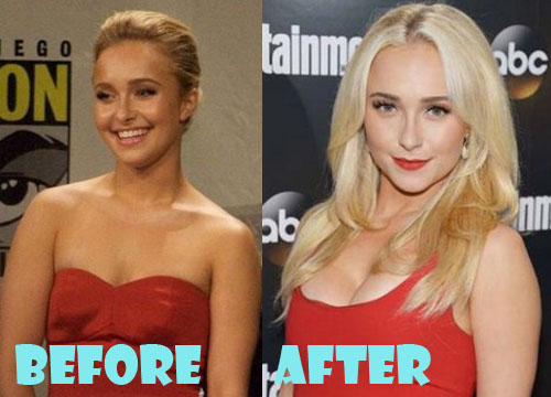 Hayden Panettiere Plastic Surgery Boob Job