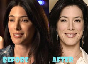 Jaime Murray Plastic Surgery