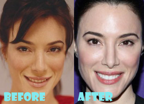 Jaime Murray Plastic Surgery Before and After Pictures