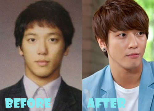 Jung Yong Hwa Plastic Surgery Before and After Picture