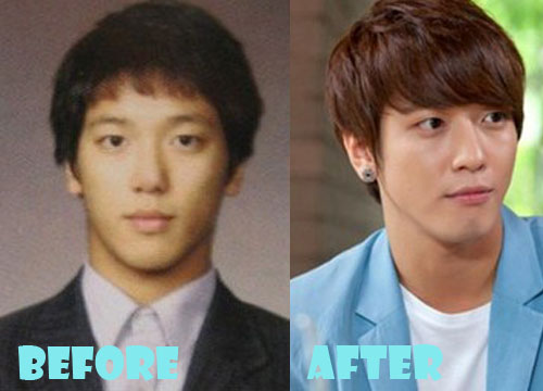 Jung Yong Hwa Plastic Surgery