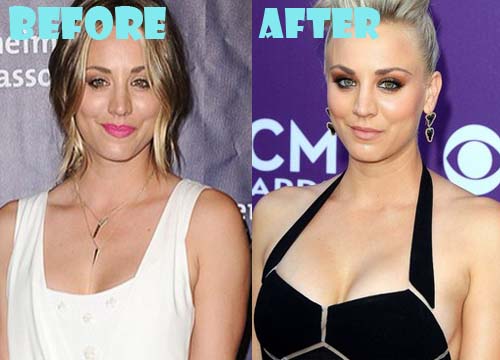 Kaley Cuoco Plastic Surgery Before and After Boob Job