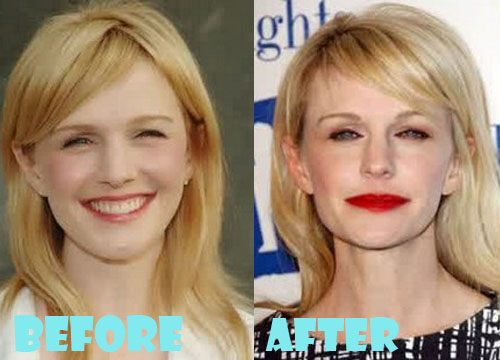 Kathryn Morris Plastic Surgery Before and After Pictures