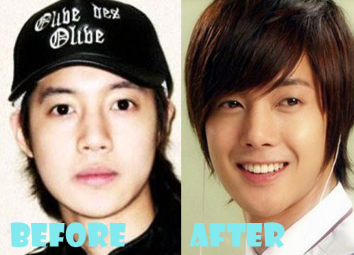 Kim Hyun Joong Plastic Surgery Before and Nose Job