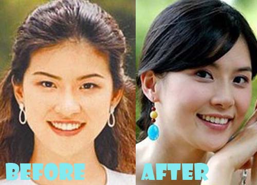 Lee Bo Young Plastic Surgery Before and After Nose Job, Eyelid Surgery