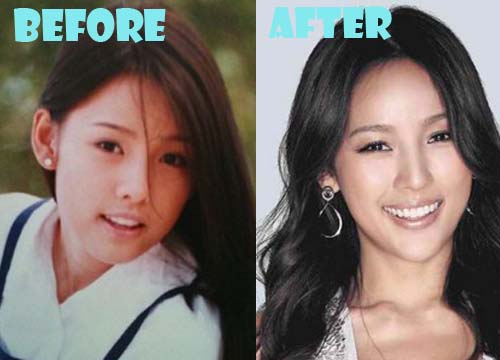 Lee Hyori Plastic Surgery Before and After Photos