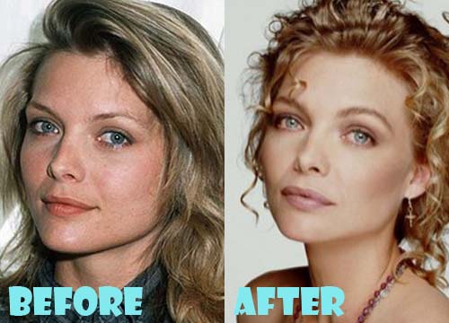 Michelle Pfeiffer Plastic Surgery Before and After Nose Job