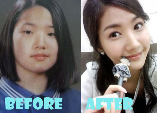 Park Min Young Plastic Surgery Before and After Picture