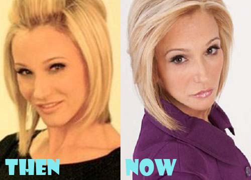 Paula White Plastic Surgery Before and After Photos