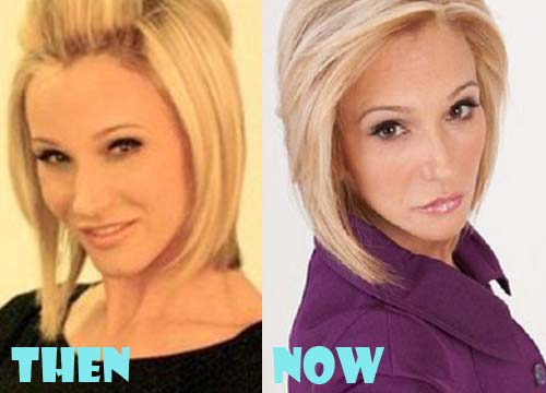 Paula White Plastic Surgery Botox, Facelift