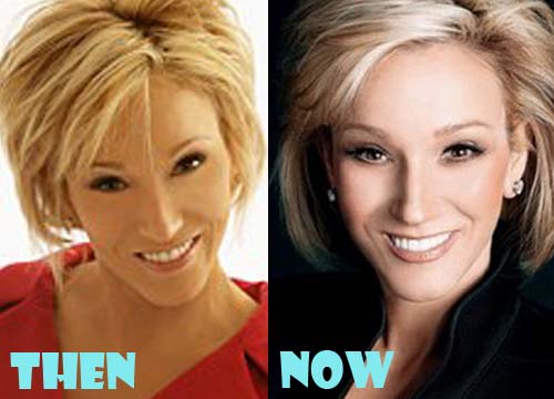 Paula White Plastic Surgery Before And After Photos Lovely Surgery